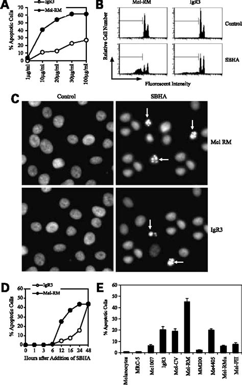 Figure 1 From The Histone Deacetylase Inhibitor Suberic Bishydroxamate