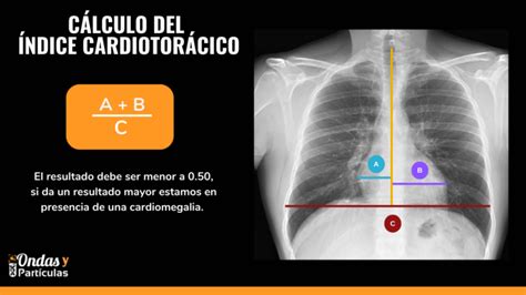 C Mo Interpretar Una Radiograf A De T Rax Primera Parte Ondas Y