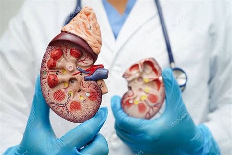 Enfermedad Renal Cr Nica M Dico Con Modelo Para El Tratamiento Del