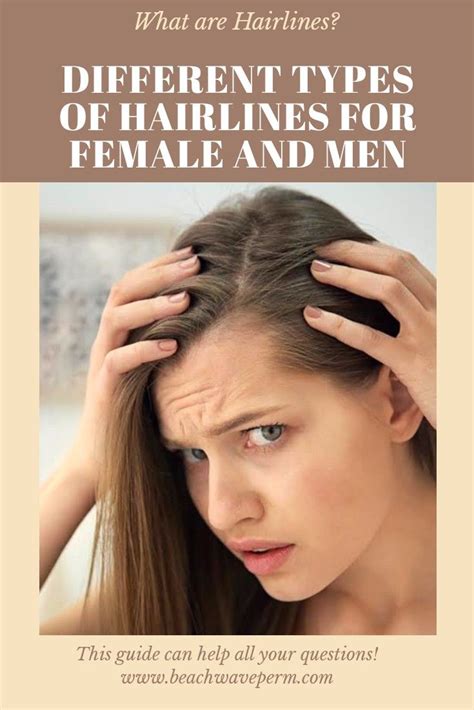 What Are Hairlines Different Types Of Hairlines For Female And Men