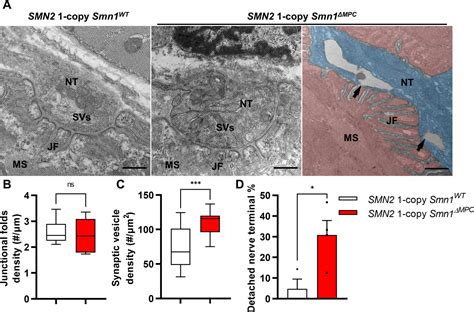 Depletion of SMN protein in mesenchymal progenitors impairs the ...