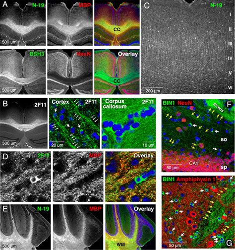 The Distribution Of BIN1 In Mouse Brain BIN1 Immunolabeling Is In