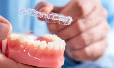 Benefits Of Invisalign For Teens And Adults A Clear Choice