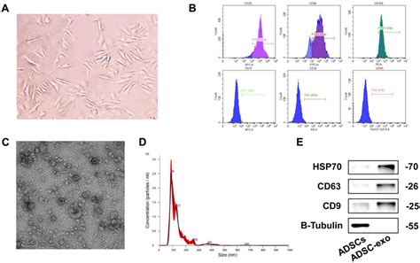 Extraction And Identification Of Adsc Exosomes A Adsc Cells Were