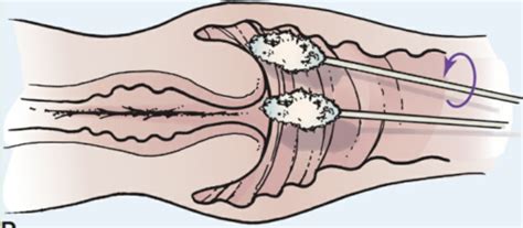 Female Genitalia Anus And Rectum Flashcards Quizlet