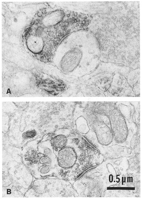 A B Electron Micrographs Of Calbindin D K Immunoreactire Synaptic