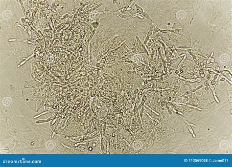 Budding Yeast Cells In Urine