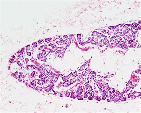 Parathyroid Gland Histology Slides