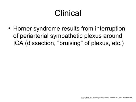 Intracranial Arteries Ppt