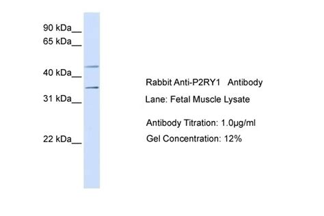 P2RY12 Antibody - Cat. No. 26-598 | ProSci