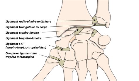 Scapholunate Sprain Dr Abdelaali Mohamed Ali