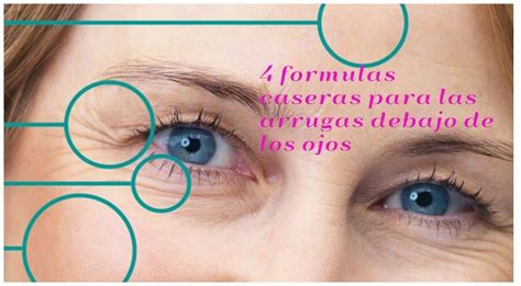 Síntesis de 21 artículos como quitar las arrugas debajo de los ojos