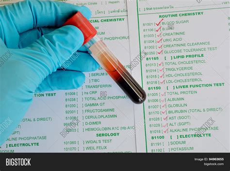 Blood Chemistry Image Photo Free Trial Bigstock