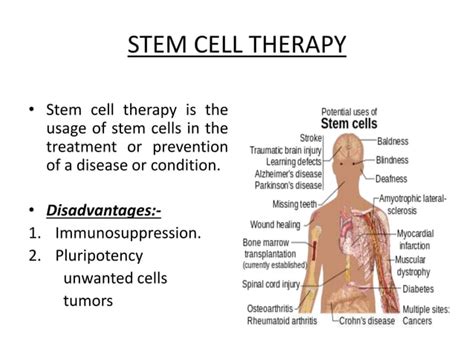 Stem Cell Therapy In Cleft Lip And Palate Ppt