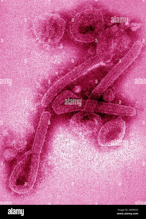 Transmission Electron Microscopic Tem Image Of Marburg Virus Virions