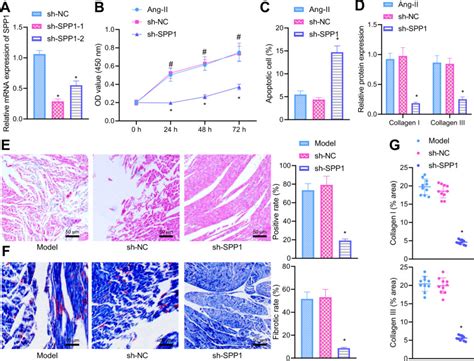 Anti Fibrotic Mechanism Of SPP1 Knockdown In Atrial Fibrosis Associates