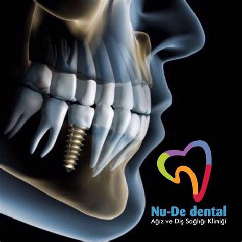 NuDe DENTAL YouTube