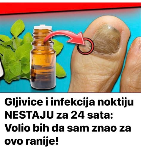 Gljivice I Infekcija Noktiju Nestaju Za Sata Volio Bih Da Sam Znao