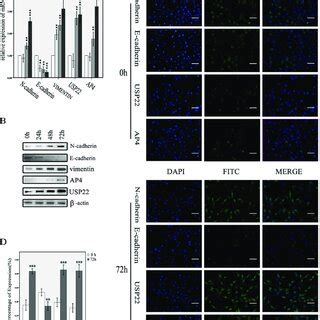 USP22 and AP4 expression in TGF β1 induced EMT cells A B RT qPCR