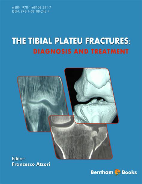 The Tibial Plateau Fractures Diagnosis And Treatment Porn Sex Picture