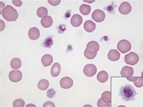 Cbc Platelets And Hemostasis Flashcards Quizlet