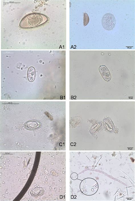 Different Parasite Stages Found In Lizards Faecal Samples With