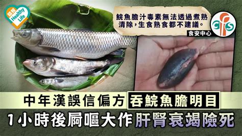 食用安全｜中年漢誤信偏方吞鯇魚膽明目 1小時後屙嘔大作肝腎衰竭險死 晴報 健康 生活健康 D210413