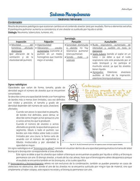 S Ndromes Pleuropulmonares Udocz