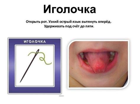 Упражнение Иголка | Oral motor, Elementary music, Oral