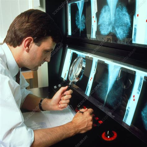 Examining X Rays Stock Image M415 0122 Science Photo Library