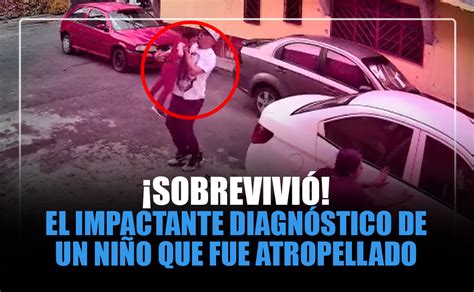 ¡sobrevivió El Impactante Diagnóstico De Un Niño Que Fue Atropellado