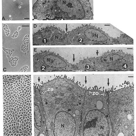 Indirect Immunofluorescence Of Cytoskeletal Proteins In Mdck Cells