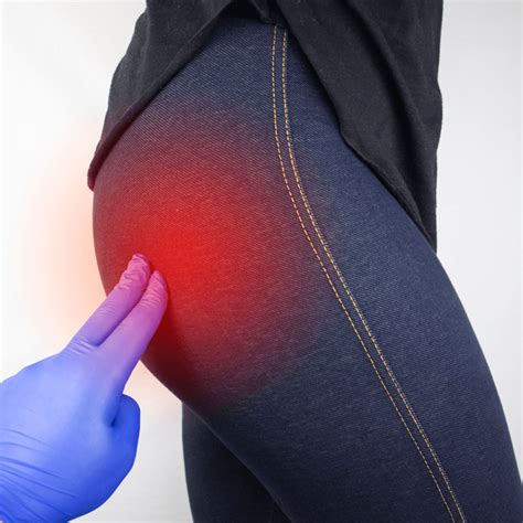 Leg And Buttock Pain Physiotherapy Greenacres