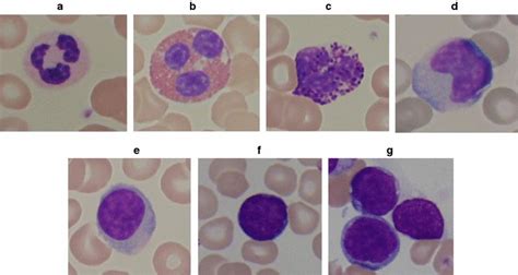 A Neutrophil Cell B Eosinophil Cell C Basophil Cell D Monocyte Cell Download Scientific