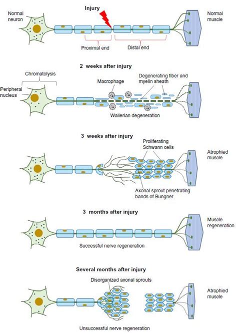 Figure 2 Cellular Responses To Nerve Injury Nerve Degeneration And