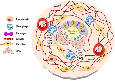 Schematic Illustration Of Phase 4 After Implantation Foreign Body Download Scientific Diagram