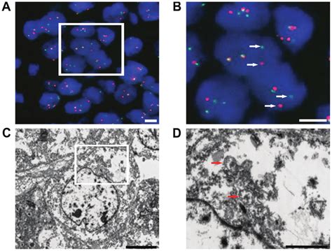 A And B Representative Image Of EWSR1 Gene Rearrangements