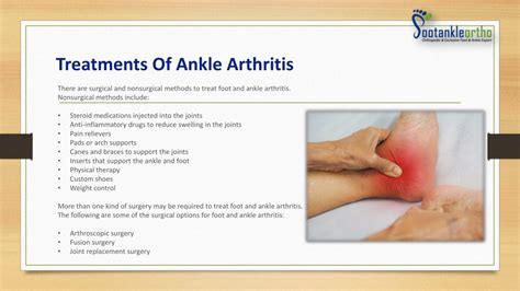 Ppt Ankle Arthritis Symptoms And Causes Footankleortho Powerpoint Presentation Id11931004