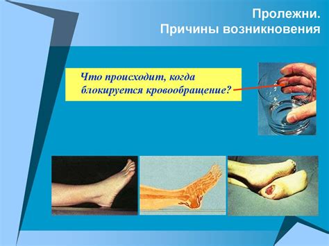 Уход за больными с нарушением двигательной активности. Профилактика ...