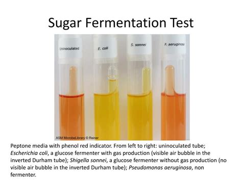 Ppt Biochemical Characterization Of Bacteria Powerpoint Presentation