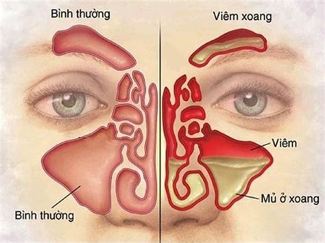 T Ng Quan V B Nh Vi M Xoang