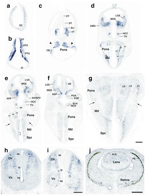 Cross Sections From E Mouse Embryos Hybridized With Dig Labeled