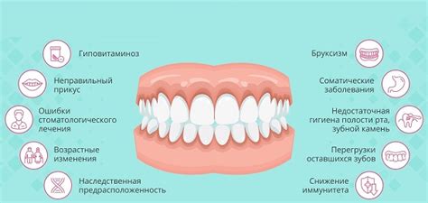 Что такое пародонтит зуба и десен? Какие симптомы? Как происходит ...