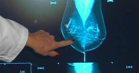 Fda Plans New Regulations On Mammograms In Effort To Help Women With