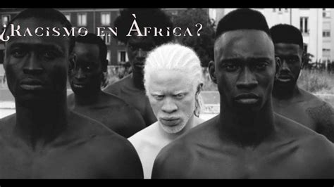 Albinos En Frica La Vida De Los Albinos En Africa Es Un Martirio