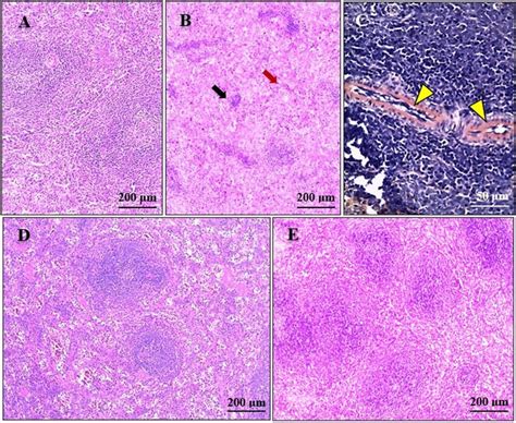 Photomicrographs Of The Spleen Sections A Normal Spleen Histological Download Scientific