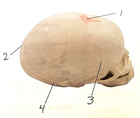 Fetal Cranium Fontanels Diagram Quizlet