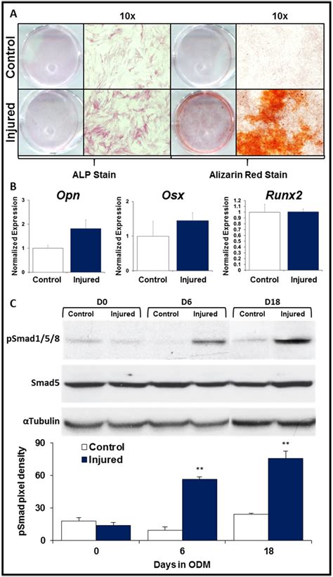 Characterization Of In Vitro Osteogenic Differentiation Of