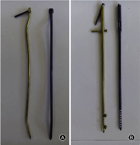 A Distal Static Locking Screw And Three Point Fixation Principle On