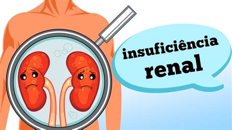 Quais Os Sintomas Da Insufici Ncia Renal Youtube